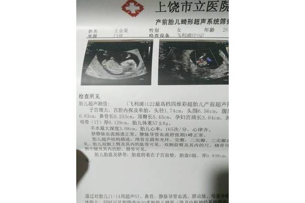 三个月有胎动吗