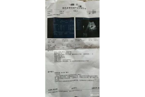 怀孕37周