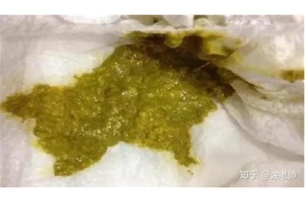 宝宝大便发绿