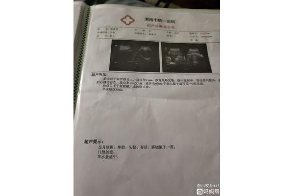 怀孕37周