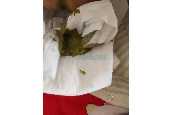 宝宝大便发绿