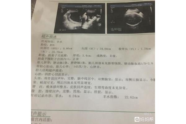 怀孕37周