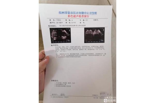 怀孕37周