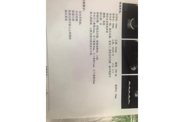 胎儿入盆是多少周