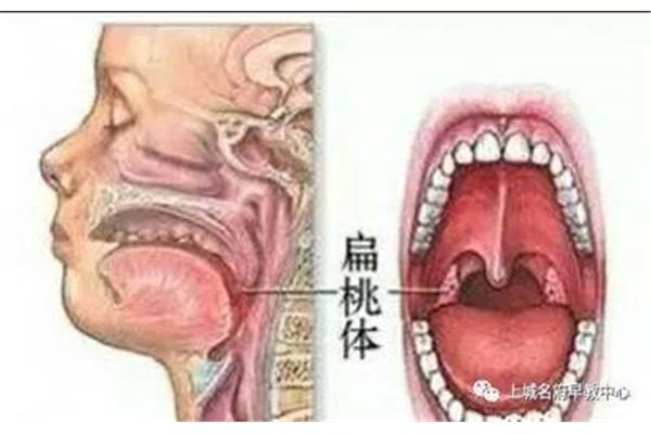 扁桃体的位置