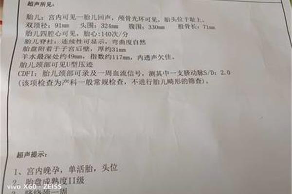 胎儿入盆是多少周