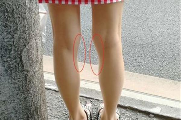 怎么把腿变直