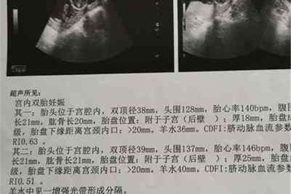 孕28周是几个月