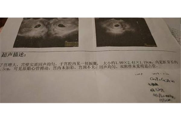 孕28周是几个月