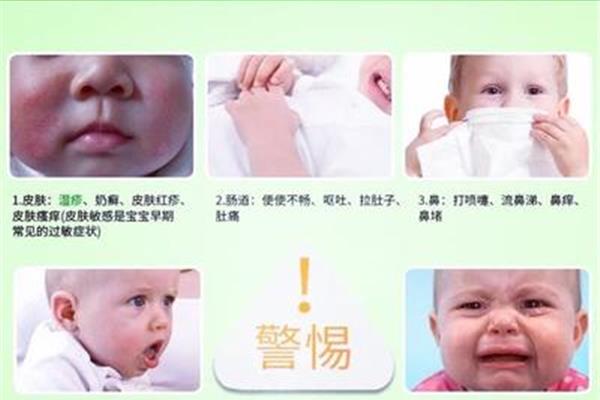 宝宝过敏症状
