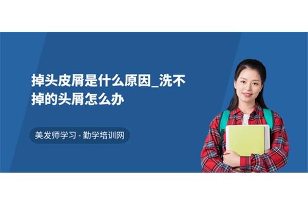 掉头皮是什么原因