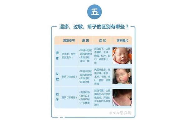 宝宝过敏症状