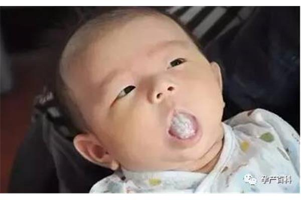 婴儿舌苔白