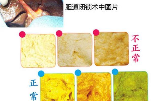 陶土样大便
