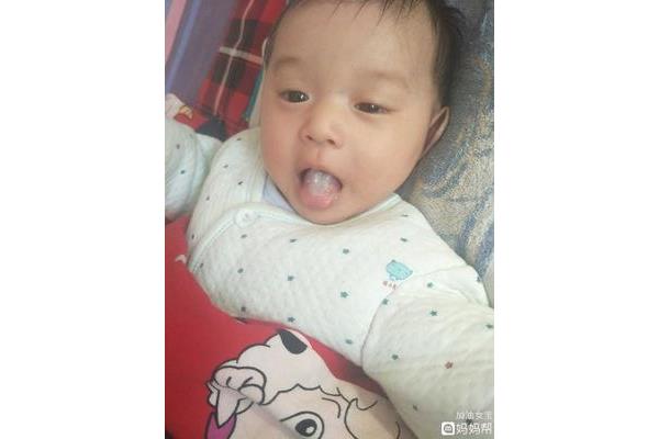 婴儿舌苔白