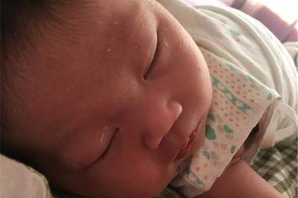 痱子会痒吗