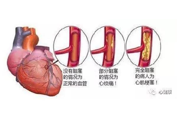 心脏和血管