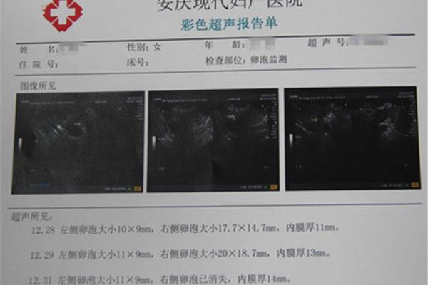 卵泡中期什么意思