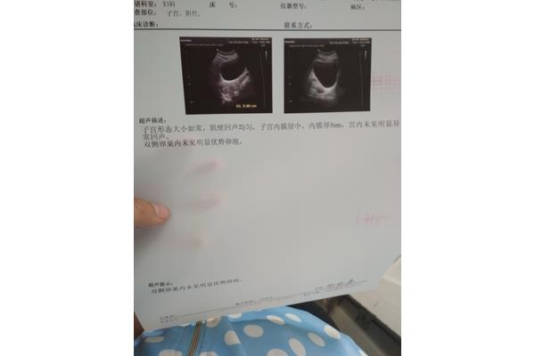 卵泡中期什么意思