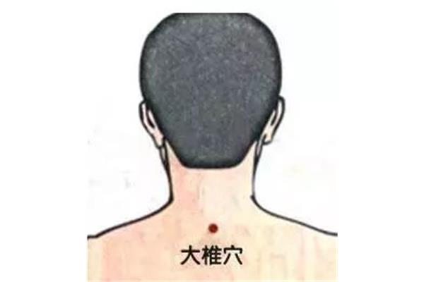 脖子可以刮痧吗