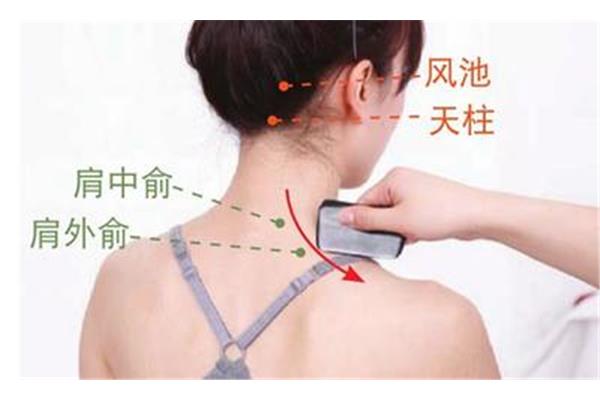 脖子可以刮痧吗