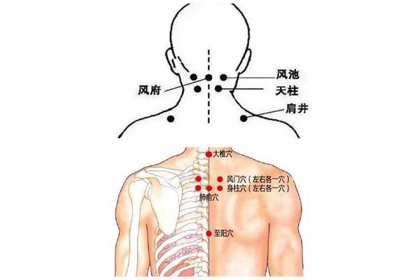 脖子可以刮痧吗