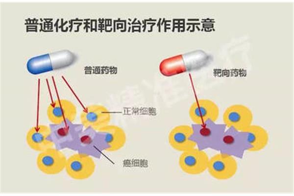 分子靶向治疗