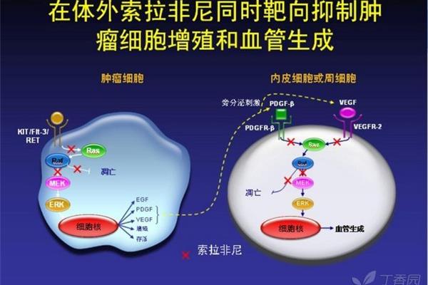分子靶向治疗