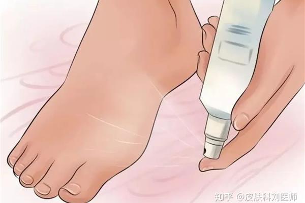 脚臭味怎么去除
