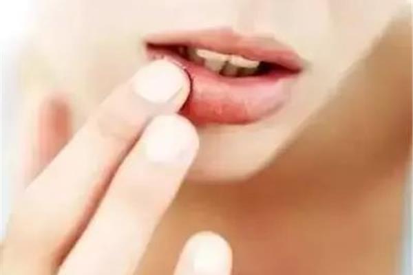 女人脾虚怎么调理