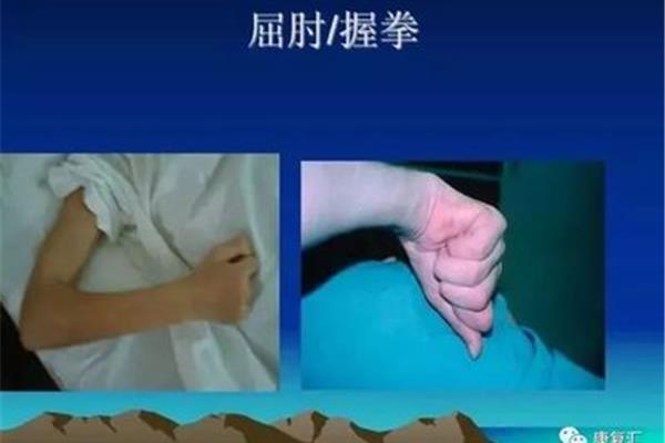 痉挛怎么治疗