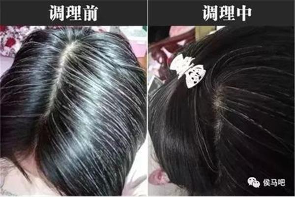 白发变黑发妙招