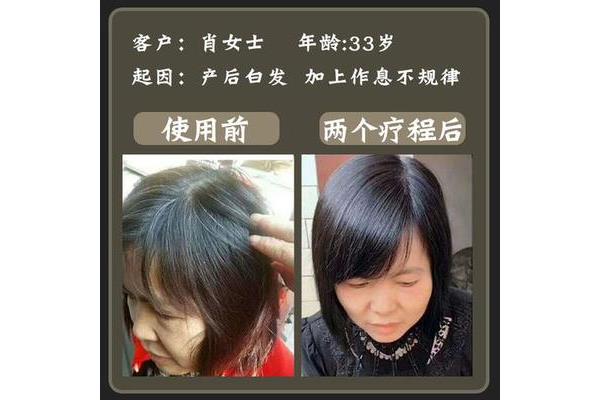 白发变黑发妙招