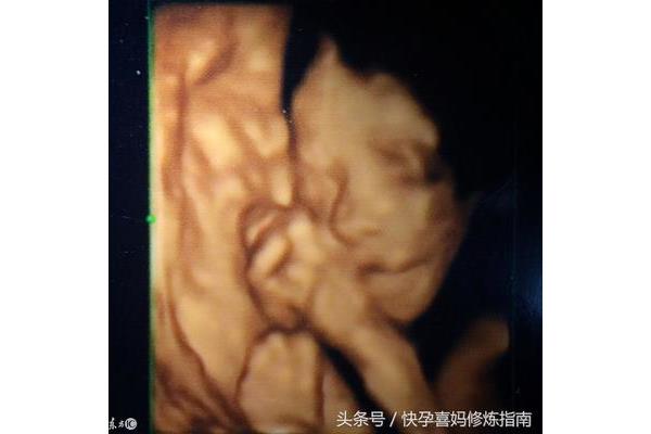 怀孕多久做四维