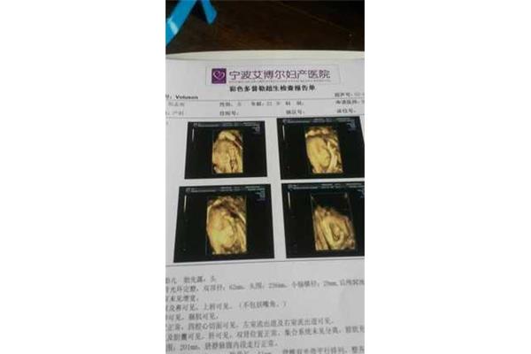 怀孕多久做四维