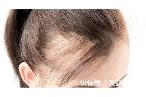 白发变黑发妙招