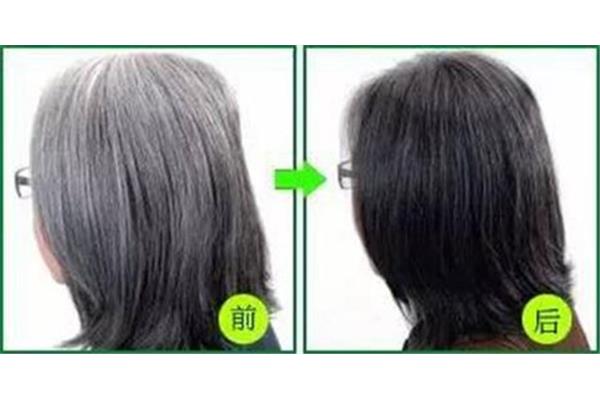 白发变黑发妙招