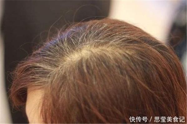 白发变黑发妙招