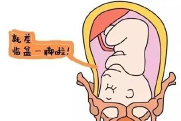 宝宝多少周入盆