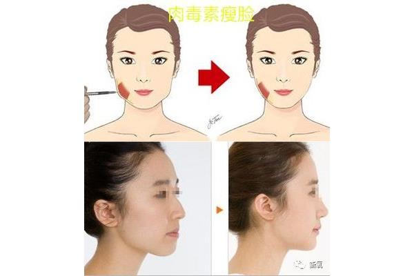 如何让脸变瘦变小