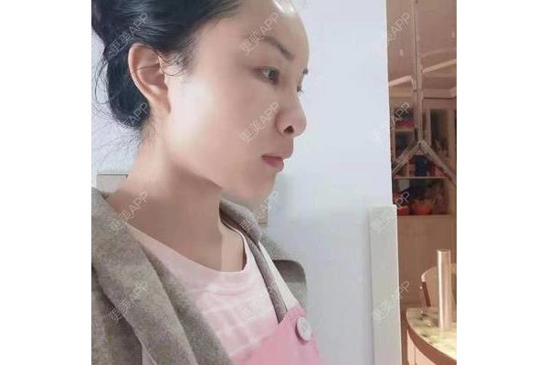 成人礼是几岁