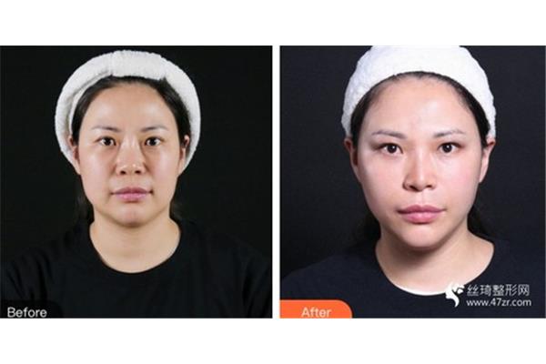 如何让脸变瘦变小