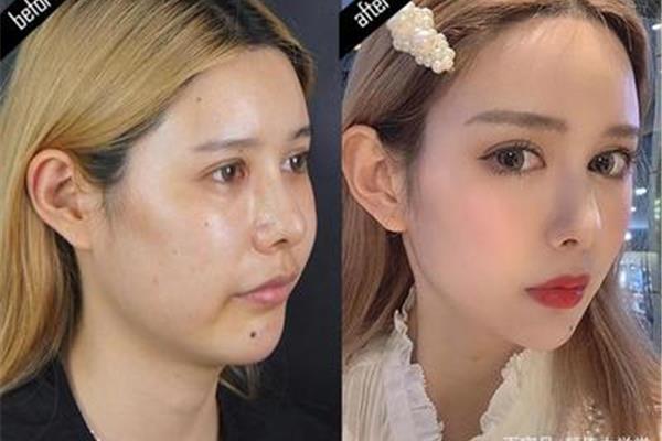 如何让脸变瘦变小