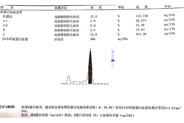 免疫固定电泳
