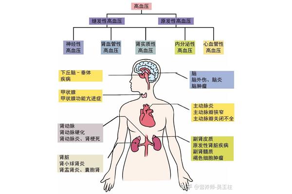 血压是什么