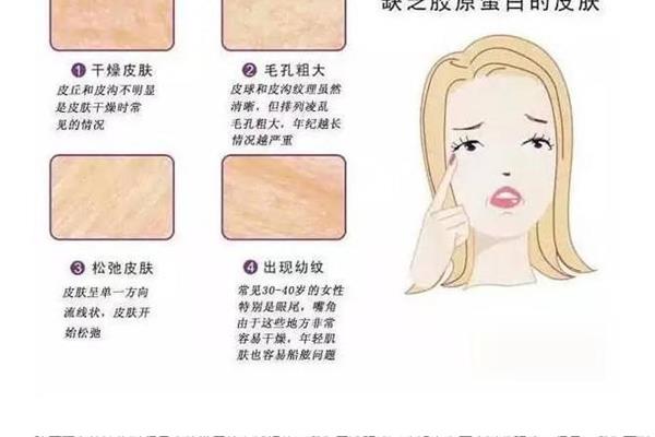 毛孔粗大原因