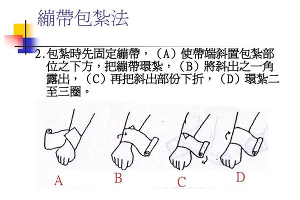 绷带包扎法