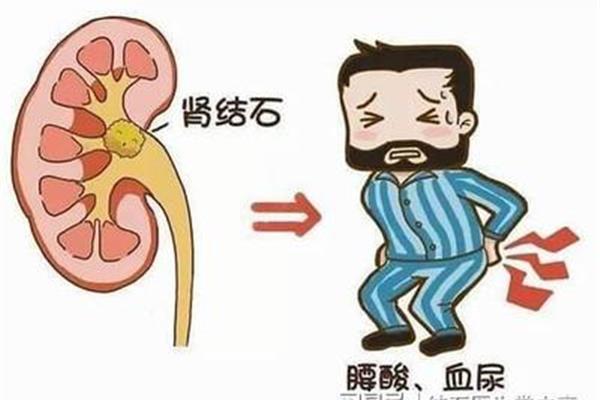 痛得像什么