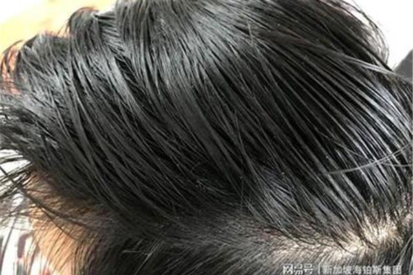 头发油是什么原因