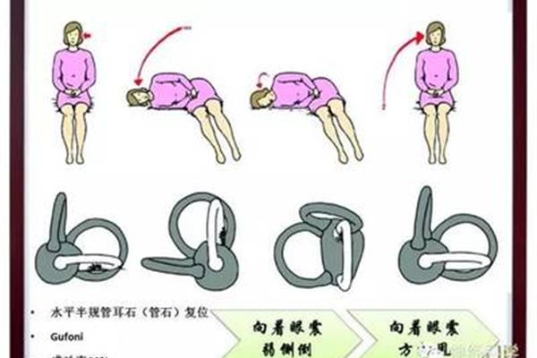 耳石复位方法